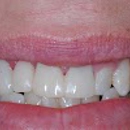 Love Dentistry - Dr. Sheri Love, DDS - Cosmetic Dentistry