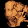BabyImage 3D/4D Ultrasound gallery