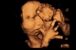 BabyImage 3D/4D Ultrasound - Medical Centers