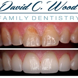 David Wood Family Dentistry - Carmel, IN