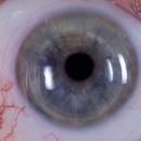Insight Vision Optometry Las Vegas - Contact Lenses