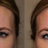 Dakota Plastic Surgery gallery