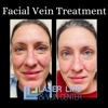 St Louis Laser Vein Center gallery