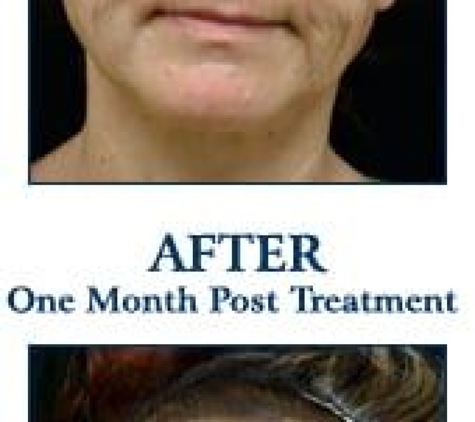 Idaho Dermatologic Surgery & Laser Center - Boise, ID