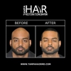 Tampa Hair Restoration Center gallery