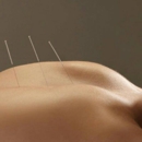 East Coast Acupuncture & Alternative Medicine - Acupuncture