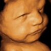 Picture Perfect 3D/4D Ultrasound Imaging gallery