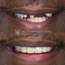Mill Plain Family Dental - Cosmetic Dentistry