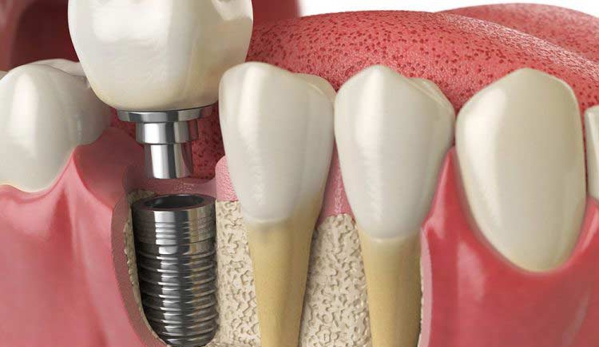 Edwards Dental - Victor Harbor, SA
