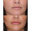 Destin Botox Laser and Facial Esthetics gallery