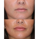 Destin Botox Laser and Facial Esthetics - Skin Care
