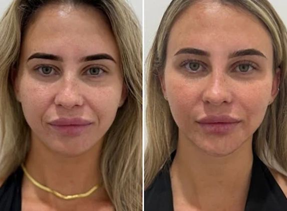 BeautyFULL Cosmetic Medical Clinic - Kingscliff, NSW