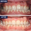 Orthodontics of Downey - Orthodontists