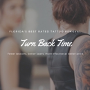 ReversaTatt Tattoo Removal - Tattoo Removal