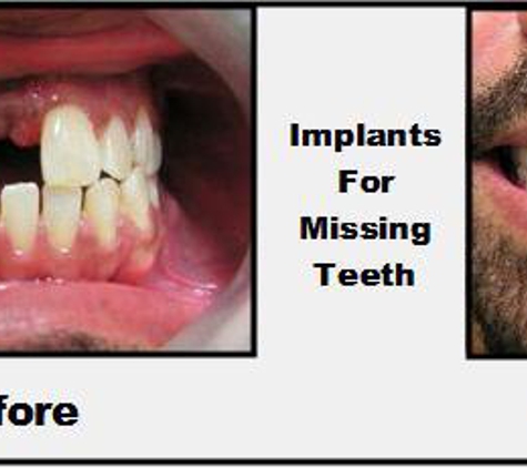 Chris A. Castellano D.M.D. P.A. - Riverview, FL. Castellano DMD
Riverview Implant dentist 813-672-1917
