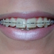 Kolodziej, Ronald P., D.M.D.,  M.S., Orthodontist