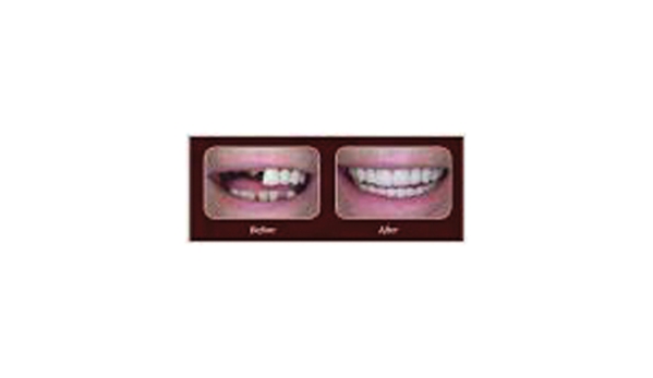 Affordable Denture Clinic - East Geelong, VIC