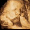 Hello Baby 3D/4D Ultrasound Studio gallery