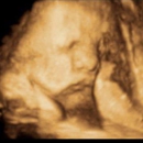Hello Baby 3D/4D Ultrasound Studio - Pregnancy Information & Services