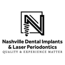 Nashville Dental Implants - Implant Dentistry