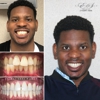 Brooklyn Invisalign Center gallery