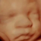 Miracle View 3D/4D 5D Ultrasound