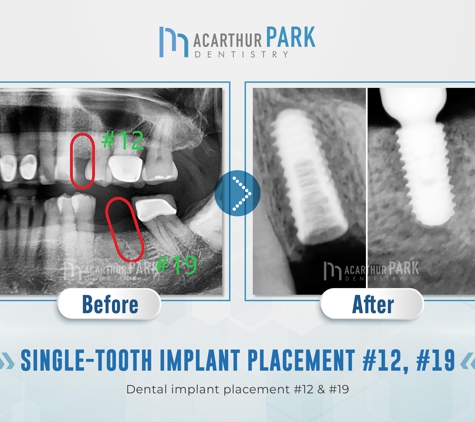 MacArthur Park Dentistry Family Cosmetic Veneers Emergency Implants Invisalign - Irving, TX