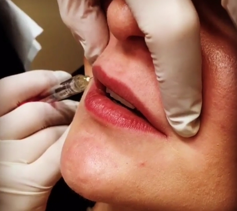 Uptown Medical Aesthetics - Denver, CO. Microdermabrasion in Northglenn, CO