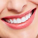 Smart Arches Dental Implants - Oral & Maxillofacial Surgery