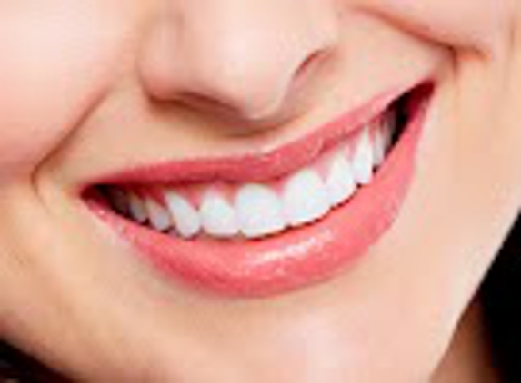 Smart Arches Dental Implants - Media, PA