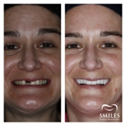 Promenade Smiles Family Dentistry Implant, Oral Surgery, and Cosmetic Dentist