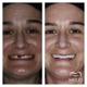 Mercer Smiles Family Dentistry Implant, Oral Surgery, and Cosmetic Dentist