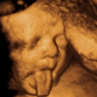 Baby's Bungalow 3D & 4D Ultrasound