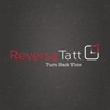 Reversatatt Tattoo Removal gallery