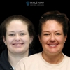 Smile Now Reno Dentures and Implants gallery