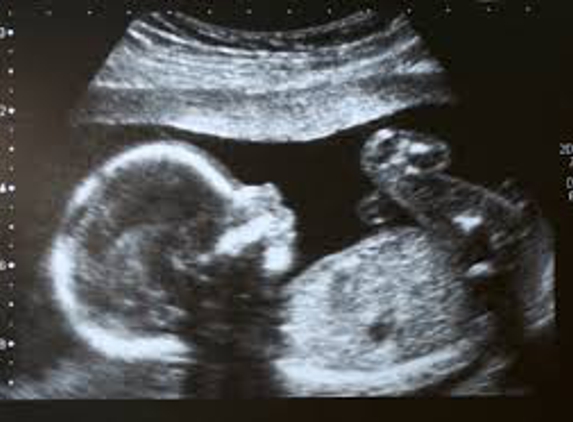 Ultrasound at Home, L.L.C. - Avondale, AZ