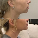 Amason Aesthetics - Physicians & Surgeons, Plastic & Reconstructive