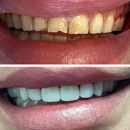 Verdugo Hills Dental Group - Dentists
