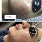 Clear Beauty Acne Clinic