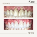 BB Dental Studio - Implant Dentistry