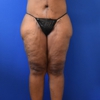 Ruston Sanchez, MD Plastic Surgery gallery