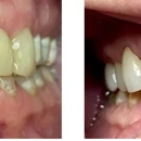 Allen Dentistry - Implant Dentistry