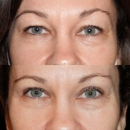 Vida Bela Plastic Surgery: Chelsea Snider MD - Day Spas