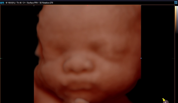 Heavenly 3d 4d Ultrasounds - Baldwin Park, CA