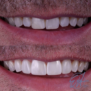 Eric Hull DDS Aesthetic & General Dentistry - Comstock Park, MI