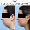 Wise Center for Plastic Surgery - Dr. Jeffrey B. Wise, MD, FACS NJ gallery