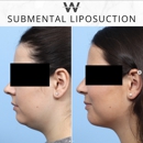 Wise Center for Plastic Surgery - Dr. Jeffrey B. Wise, MD, FACS NJ - Day Spas