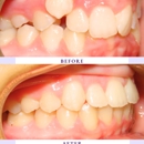Above & Beyond Orthodontics - Orthodontists