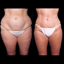 Metropolitan Plastic Surgery - Physicians & Surgeons, Plastic & Reconstructive