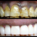 Caliber Dental